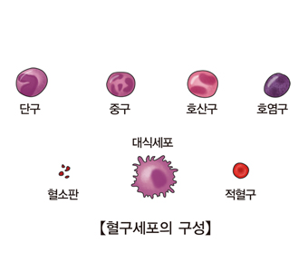 거대적아구성 빈혈