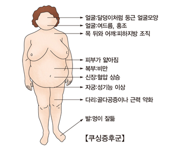 쿠싱증후군