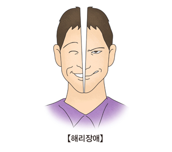 해리장애