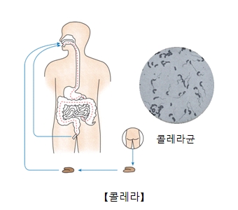 콜레라