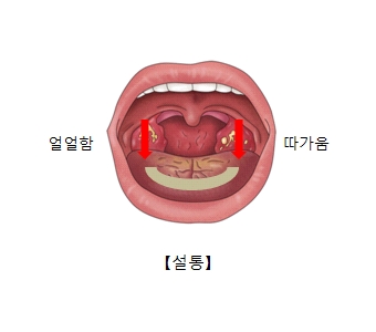 설통