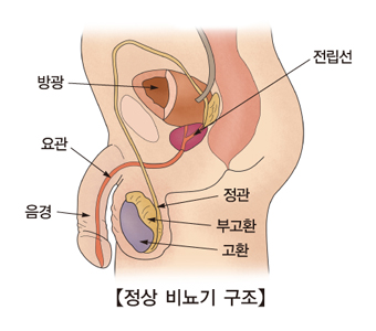 혈정액증