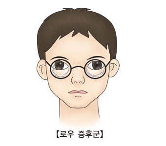 로우 증후군