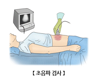 복부 초음파