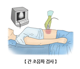 간 초음파 검사