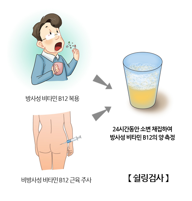 쉴링테스트